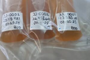 Recolección de Plasma Humano por Recuperación / Centro Hospitalario